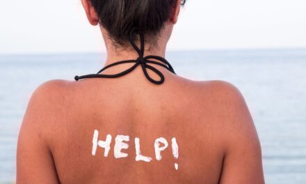 6 θαυματουργά tips για να καταπολεμήσετε τα έγκαυμα από τον ήλιο!