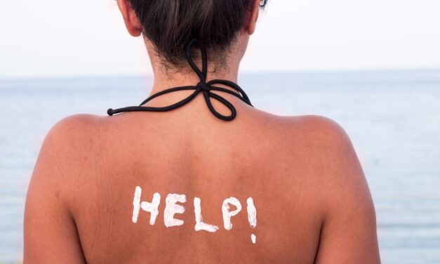 6 θαυματουργά tips για να καταπολεμήσετε τα έγκαυμα από τον ήλιο!